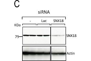 SNX9 depletion phenocopies CHC depletion during mitosis. (SNX18 Antikörper  (C-Term))