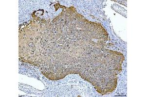 IHC analysis of MASPIN using anti-MASPIN antibody (ABIN7599298).
