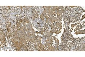 IHC analysis of PLTP using anti-PLTP antibody (ABIN7600346). (PLTP Antikörper  (AA 18-470))