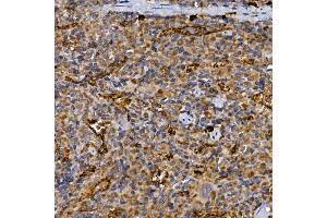 Immunohistochemistry of paraffin-embedded rat spleen using CD26/DPP4 Rabbit pAb (ABIN6130064, ABIN6139794, ABIN6139795 and ABIN6218546) at dilution of 1:25 (40x lens). (DPP4 Antikörper  (AA 29-280))