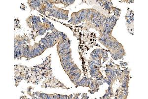 IHC analysis of LPP using anti LPP antibody (ABIN7602831). (LPP Antikörper  (C-Term))