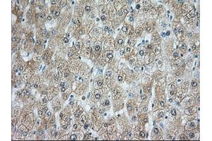 Immunohistochemical staining of paraffin-embedded Human prostate tissue using anti-RAB17 mouse monoclonal antibody. (RAB17 Antikörper)
