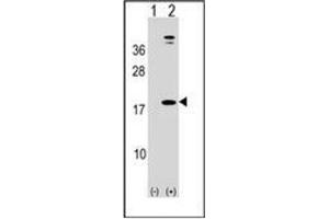 Western blot analysis of LEP (arrow) using Leptin Antibody (N-term) Cat. (Leptin Antikörper  (N-Term))