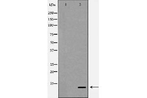 Western blot analysis of SDF 1 expression in HepG2 cells,The lane on the left is treated with the antigen-specific peptide. (CXCL12 Antikörper  (C-Term))