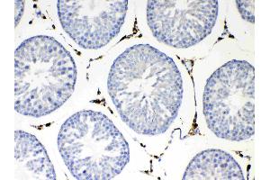 Immunohistochemistry (IHC) image for anti-N-Ethylmaleimide-Sensitive Factor (NSF) (AA 620-744) antibody (ABIN5693126)