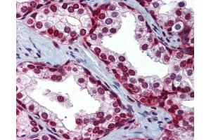 Anti-SLC35A5 antibody IHC of human prostate. (SLC35A5 Antikörper  (AA 36-85))