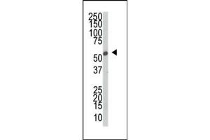 Western blot analysis of anti-SRPK2 Pab (ABIN391795 and ABIN2841650) in mouse thymus tissue lysate. (SRPK2 Antikörper  (C-Term))