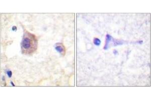 Immunohistochemistry analysis of paraffin-embedded human brain, using PKD1/PKC mu (Phospho-Tyr463) Antibody. (PKC mu Antikörper  (pTyr463))