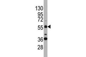 Western blot analysis of SOX9 antibody and K562 lysate. (SOX9 Antikörper  (AA 41-70))