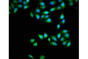 Immunofluorescence staining of Hela cells with ABIN7150152 at 1:133, counter-stained with DAPI. (APOBEC3D Antikörper  (AA 250-371))