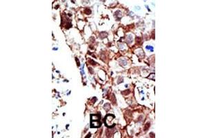Immunohistochemistry (Paraffin-embedded Sections) (IHC (p)) image for anti-Protein Inhibitor of Activated STAT, 2 (PIAS2) (AA 1-30), (C-Term) antibody (ABIN1882114)
