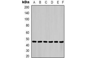 Western blot analysis of Cytokeratin 18 expression in HepG2 (A), Hela (B), mouse liver (C), mouse skeletal muscle (D), C2C12 (E), rat heart (F) whole cell lysates. (Cytokeratin 18 Antikörper)