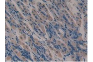 Detection of LTF in Mouse Stomach Tissue using Polyclonal Antibody to Lactoferrin (LTF)