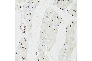 Immunohistochemistry of paraffin-embedded mouse heart using SFPQ antibody (ABIN5970351) at dilution of 1/100 (40x lens).