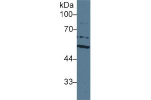 Detection of ACHE in Human HepG2 cell lysate using Polyclonal Antibody to Acetylcholinesterase (ACHE) (Acetylcholinesterase Antikörper  (AA 157-332))