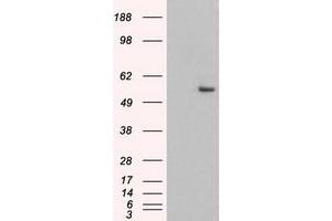 Image no. 3 for anti-Keratin 8 (KRT8) (AA 91-381) antibody (ABIN1491712) (KRT8 Antikörper  (AA 91-381))