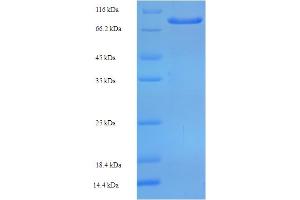 SDS-PAGE (SDS) image for Zinc Finger Protein 165 (ZNF165) (AA 1-485), (full length) protein (His-SUMO Tag) (ABIN5710646) (ZNF165 Protein (AA 1-485, full length) (His-SUMO Tag))