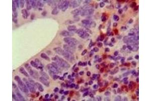 Immunohistochemistry (IHC) image for anti-Hemopoietic Cell Kinase (HCK) (truncated) antibody (ABIN2464063)