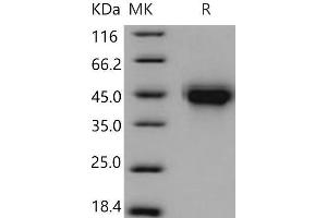 Western Blotting (WB) image for Tumor Necrosis Factor Receptor Superfamily, Member 1B (TNFRSF1B) (Active) protein (His tag) (ABIN7320395) (TNFRSF1B Protein (His tag))