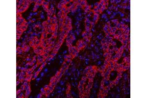 IF analysis of CLASP1 using anti-CLASP1 antibody (ABIN7599144). (CLASP1 Antikörper  (AA 1-243))