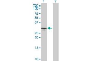 Western Blotting (WB) image for CDK4 293T Cell Transient Overexpression Lysate(Denatured) (ABIN1331302)