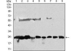 Western blot analysis using CSNK2B mouse mAb against Hela (1), Jurkat (2), K562 (3), HepG2 (4), C6 (5), SK-N-SH (6), NTERA-2 (7), MCF-7 (8), NIH/3T3 (9) cell lysate. (CSNK2B Antikörper  (AA 1-215))