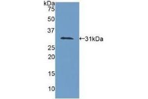 Detection of Recombinant COL4a1, Human using Polyclonal Antibody to Collagen Type IV Alpha 1 (COL4a1) (COL4A1 Antikörper  (AA 1444-1669))