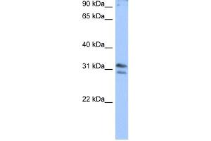 WB Suggested Anti-RG9MTD3 Antibody Titration:  0.