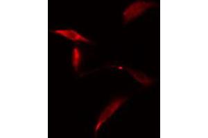 ABIN6274829 staining A549 cells by IF/ICC. (AKR1E2 Antikörper  (Internal Region))