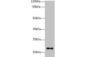 Western blot All lanes: JAGN1 antibody at 3 μg/mL + HL60 whole cell lysate Secondary Goat polyclonal to rabbit IgG at 1/10000 dilution Predicted band size: 22 kDa Observed band size: 22 kDa