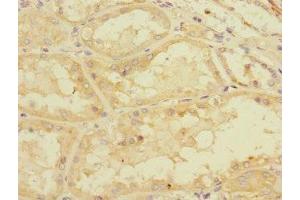 Immunohistochemistry of paraffin-embedded human kidney tissue using ABIN7160526 at dilution of 1:100 (PDE4DIP Antikörper  (AA 1-310))