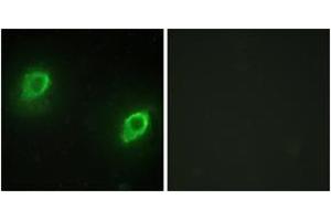 Immunofluorescence analysis of HeLa cells, using AKAP5 Antibody. (AKAP5 Antikörper  (AA 1-50))