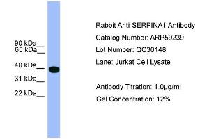 WB Suggested Anti-SERPINA1  Antibody Titration: 0. (SERPINA1 Antikörper  (C-Term))