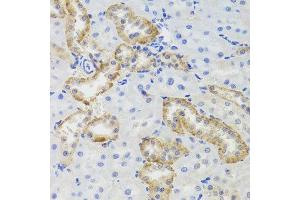 Immunohistochemistry of paraffin-embedded rat kidney using MTERFD3 antibody at dilution of 1:100 (x40 lens). (MTERFD3 Antikörper)