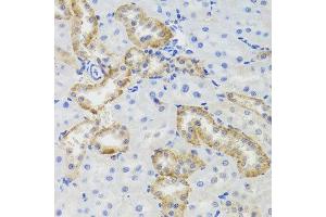 Immunohistochemistry of paraffin-embedded rat kidney using MTERFD3 antibody at dilution of 1:100 (x40 lens).