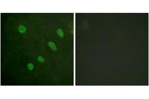 Immunofluorescence analysis of HeLa cells, using ATF2 (Phospho-Ser480) Antibody. (ATF2 Antikörper  (pSer480))