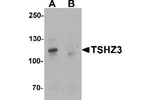Western blot analysis of TSHZ3 in mouse brain tissue lysate with TSHZ3 antibody at 1 µg/mL in (A) the absence and (B) the presence of blocking peptide. (TSHZ3 Antikörper  (N-Term))