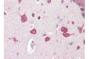 Human Brain, Cortex (formalin-fixed, paraffin-embedded) stained with TSLPat 2. (Thymic Stromal Lymphopoietin Antikörper)