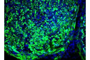 Immunofluorescent staining of human ES cell line (TRA1-60 Antikörper)