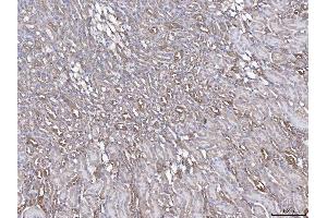 IHC analysis of ANXA4 using anti-ANXA4 antibody (ABIN5518805).