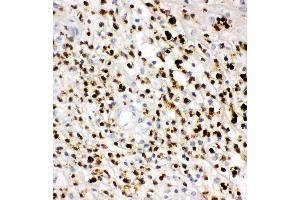 Immunohistochemistry (IHC) image for anti-Myeloperoxidase (MPO) (AA 406-745) antibody (ABIN3042368)