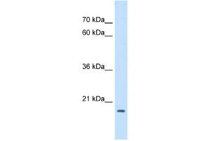 ASF1B antibody used at 1 ug/ml to detect target protein. (ASF1B Antikörper)