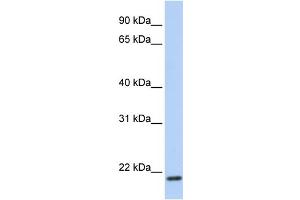 WB Suggested Anti-TMEM35 Antibody Titration:  0. (TMEM35 Antikörper  (C-Term))