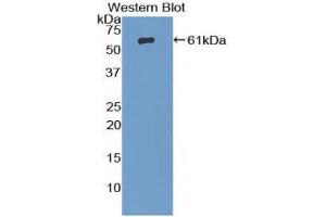 Western Blotting (WB) image for anti-beta-Adrenergic Receptor Kinase (AA 398-640) antibody (ABIN1857927) (beta-Adrenergic Receptor Kinase (AA 398-640) Antikörper)