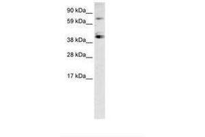 Image no. 2 for anti-Sp7 Transcription Factor (SP7) (C-Term) antibody (ABIN6735947) (SP7 Antikörper  (C-Term))