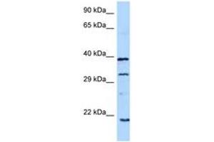 Image no. 1 for anti-Growth Hormone 1 (GH1) (C-Term) antibody (ABIN6748200) (Growth Hormone 1 Antikörper  (C-Term))