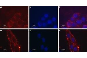 Expression of Melanin-concentrating hormone receptor 1 in mouse brain glioma - Cell surface detection of MCHR1 in mouse brain glioma (C6) intact living cells. (MCHR1 Antikörper  (Extracellular))