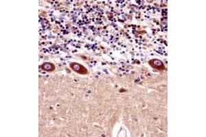 Immunohistochemistry analysis in formalin fixed and paraffin embedded human cerebellum tissuereacted with KCNA1 Antibody (Center) followed which was peroxidase conjugated to the secondary antibody and followed by DAB staining. (KCNA1 Antikörper  (Middle Region))