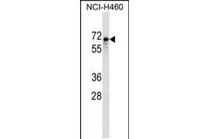 Western blot analysis in NCI-H460 cell line lysates (35ug/lane). (SNTB1 Antikörper  (AA 243-271))