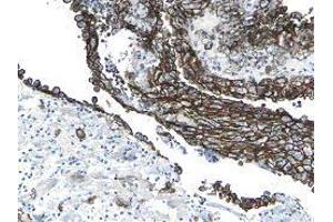 Immunohistochemistry (IHC) image for anti-Podoplanin (PDPN) antibody (ABIN180856) (Podoplanin Antikörper)